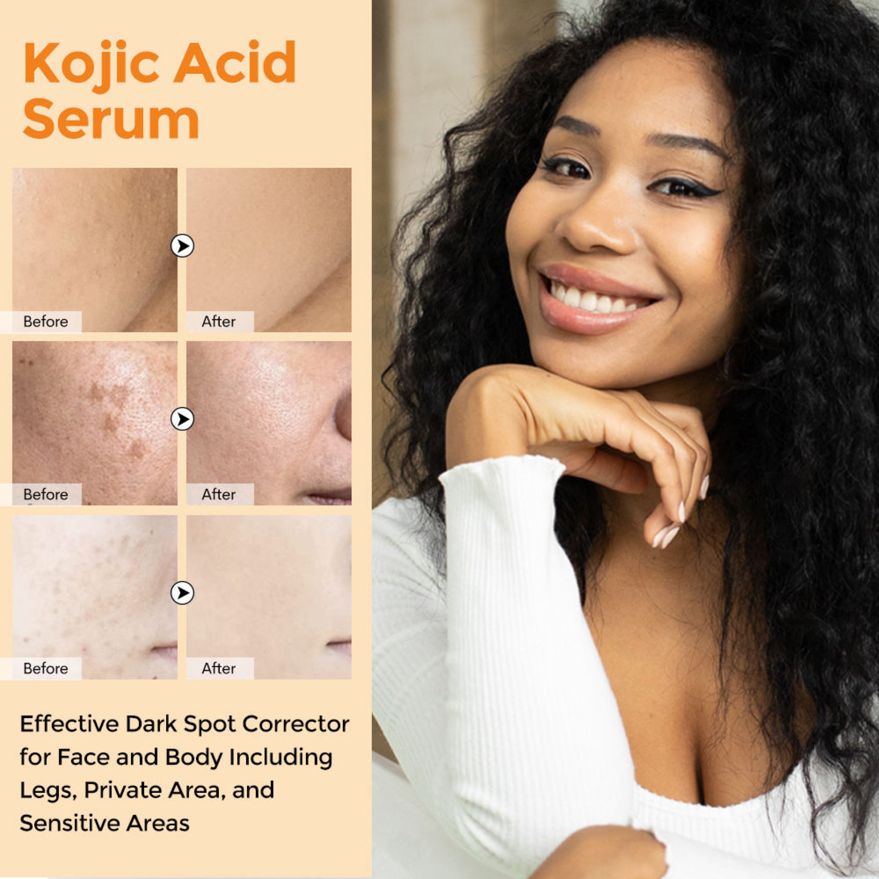 Kojic acid Serum 30ml For Brightening, Moisturizing, Dark Spot, Blemish Control by Oreola Naturals.