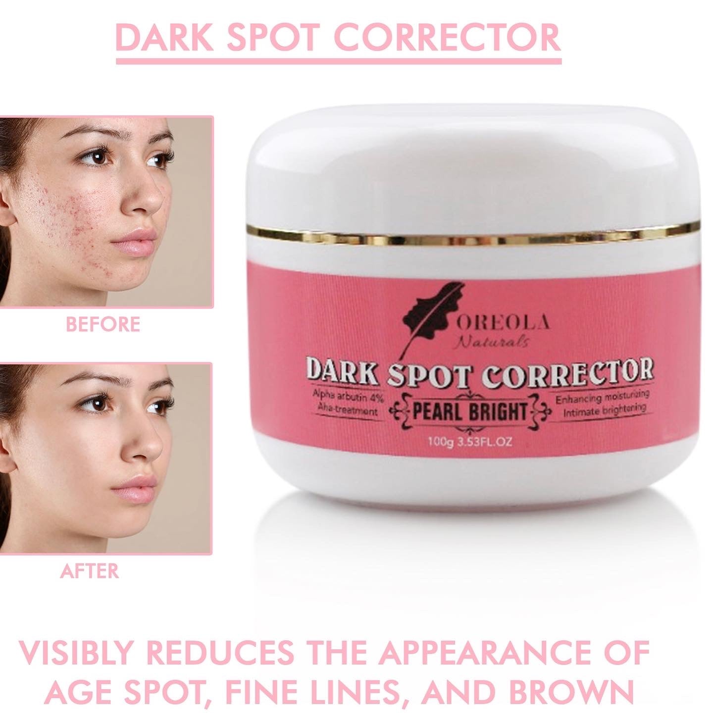 Dark Spot Corrector Removal Cream 100g/3.5oz