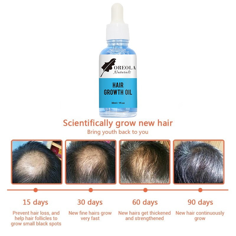 Hair Oil For Longer, Thicker, Stronger Hair 30ml/1oz